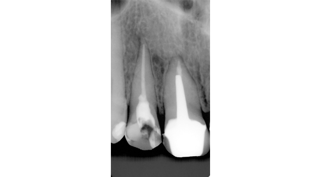 MasterDent - endodoncja